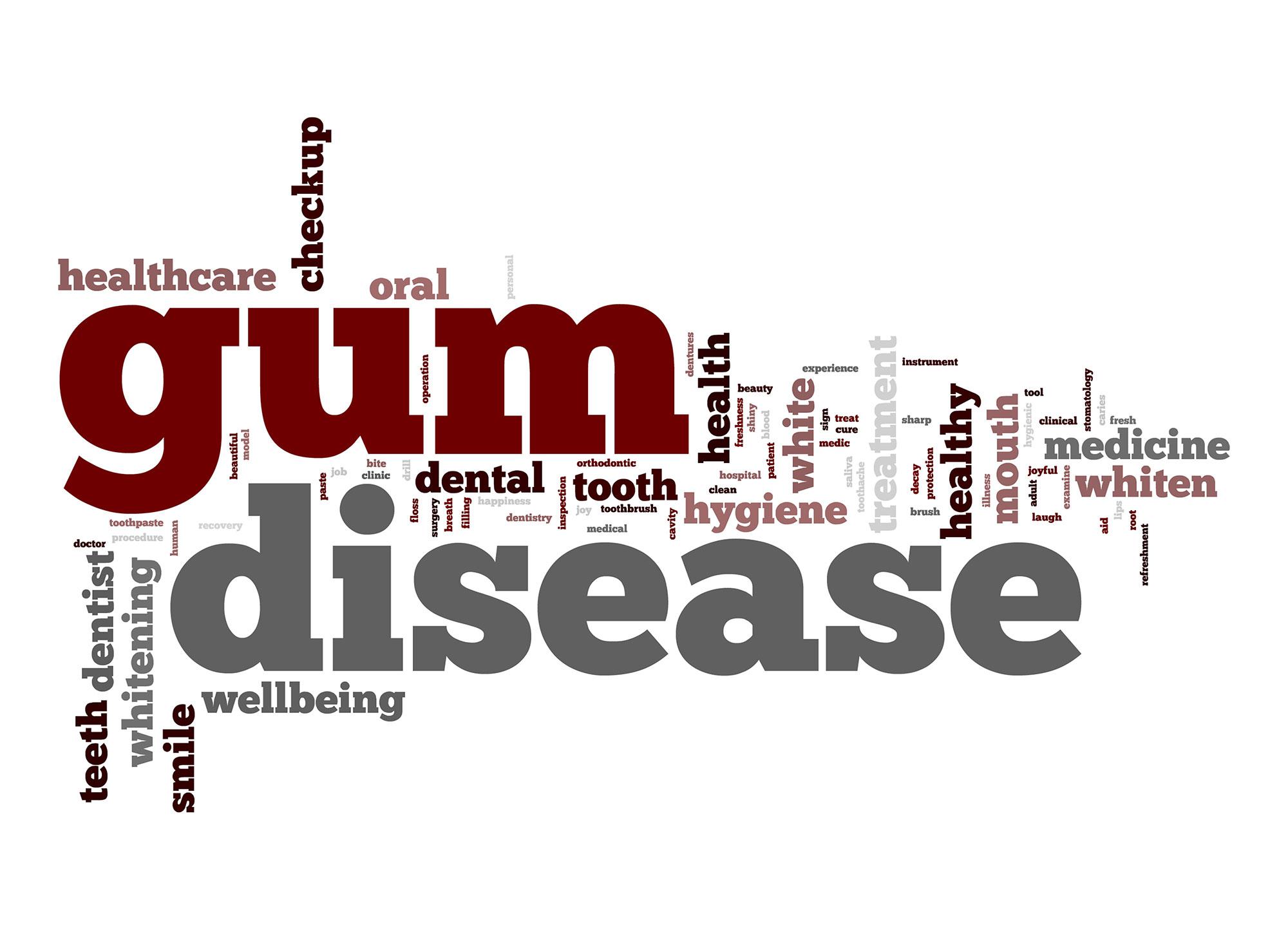 treatment for gum disease in San Ramon, CA